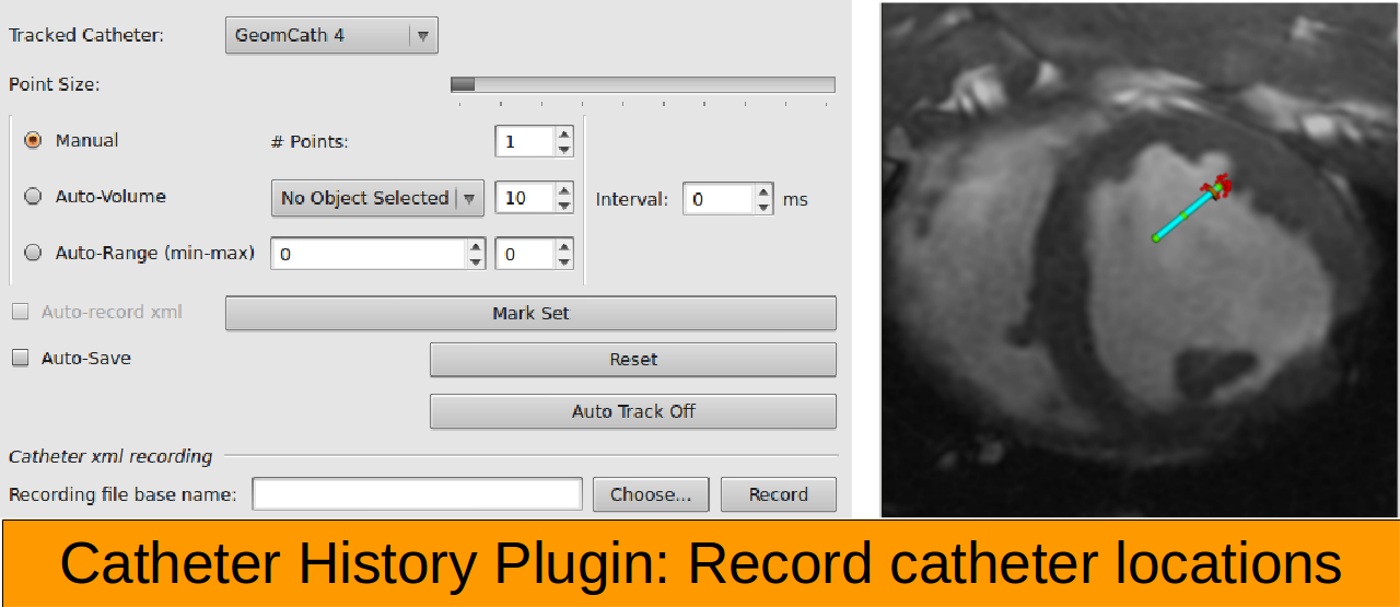 10_cathHistoryPlugin.png