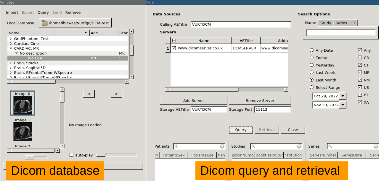 4_dcmDb-query.png