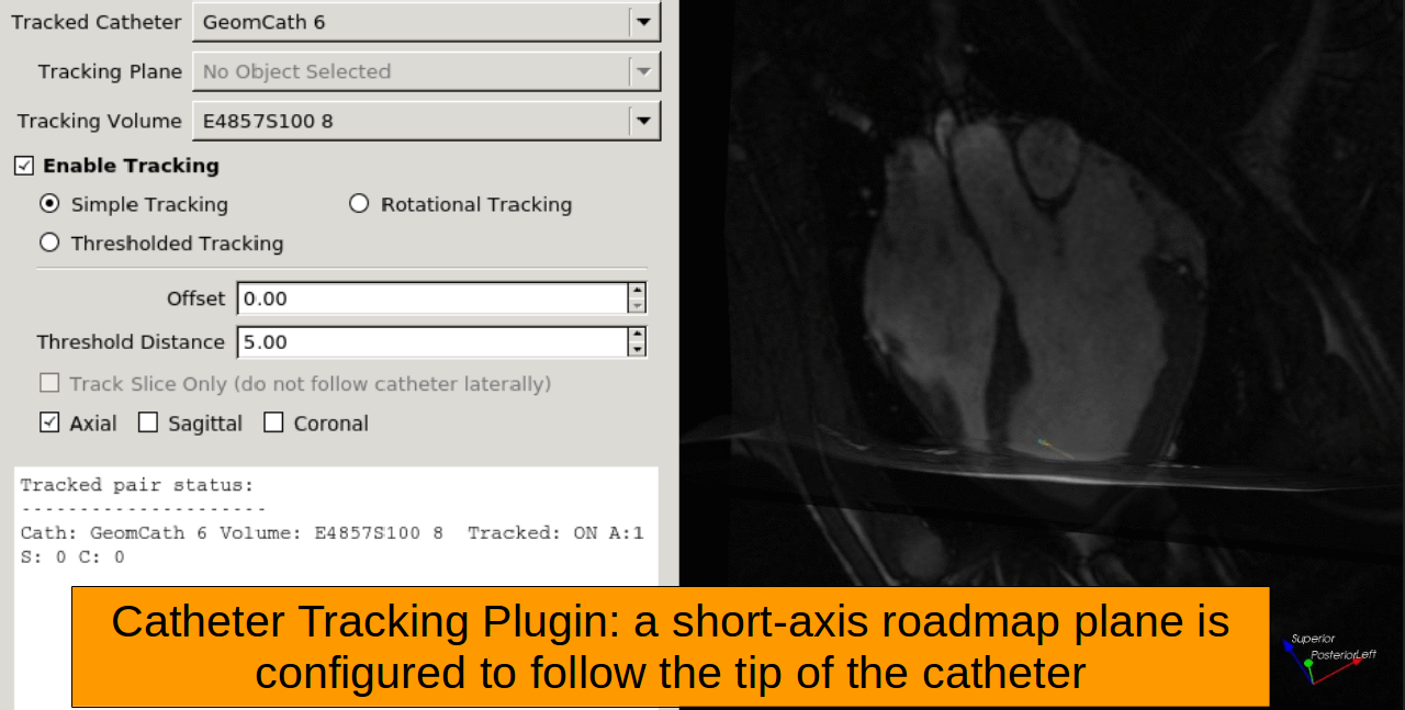9_cathTrackingPlugin.png